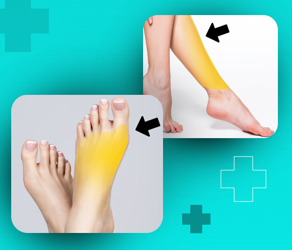 Depilação a laser em Buritis