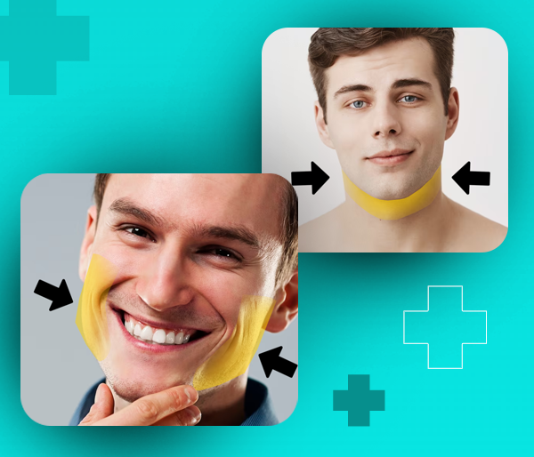 Depilação a laser em Buritis