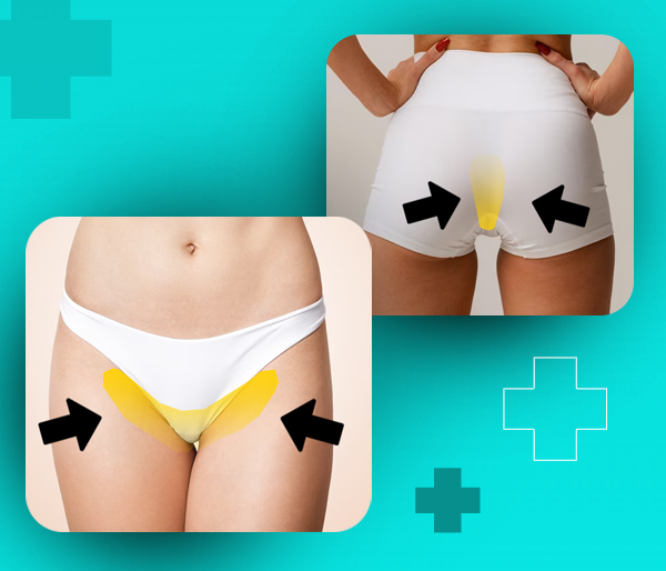 Depilação a laser em Buritis