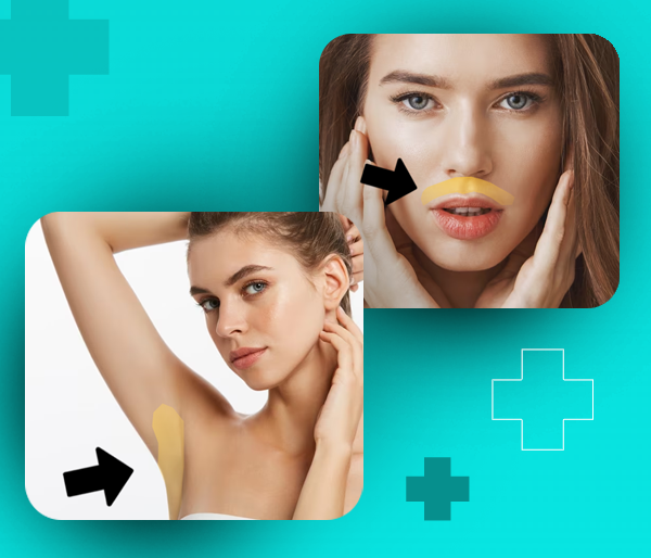 Depilação a laser em Buritis